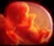 Aborsi-Net